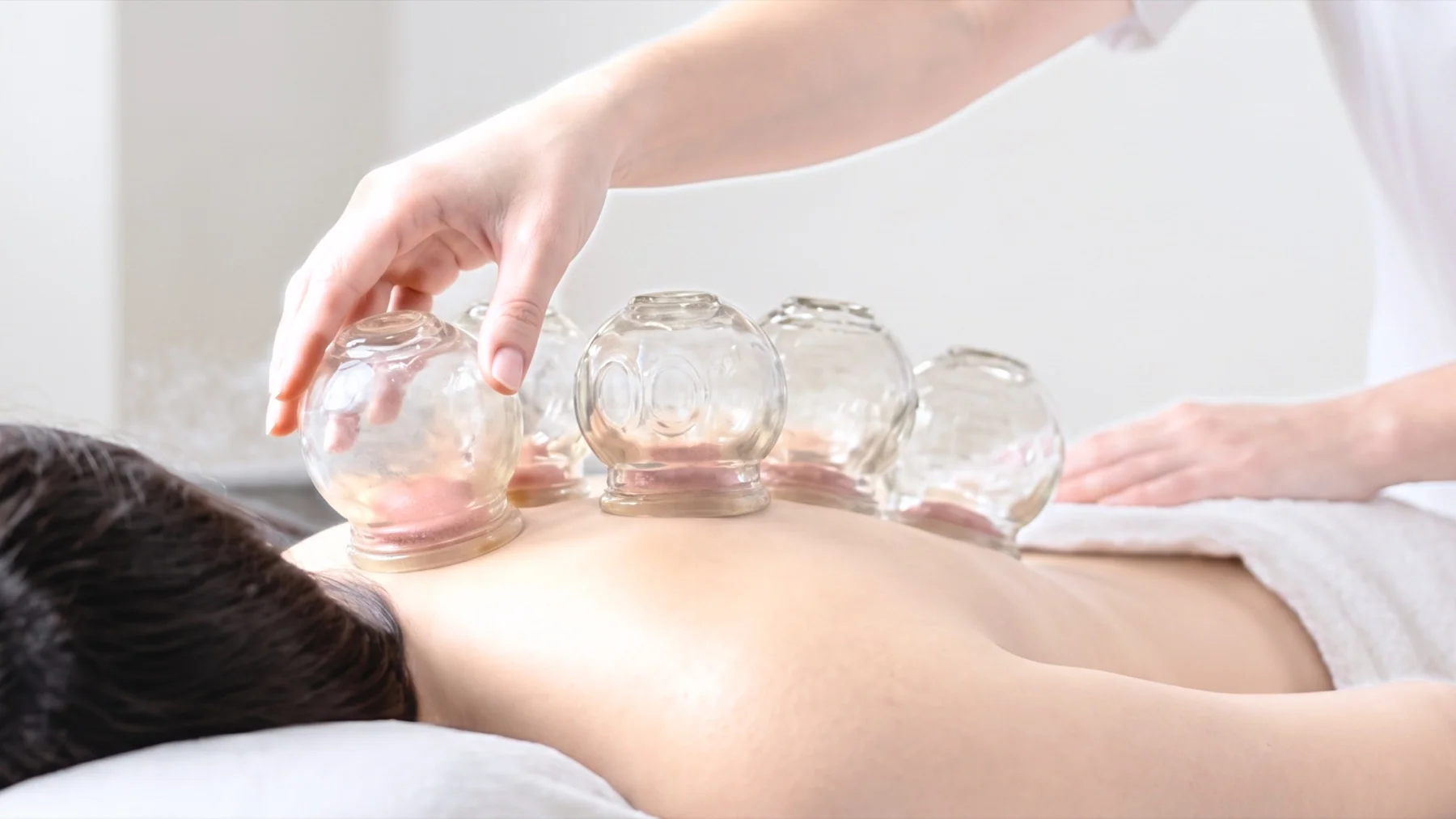 A carefully arranged, professional cupping session on an adult client's upper back in a clean home environment, showing equipment without dramatic flames or exaggerated skin marks.